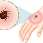 How to Get Rid of Ticks from Yard